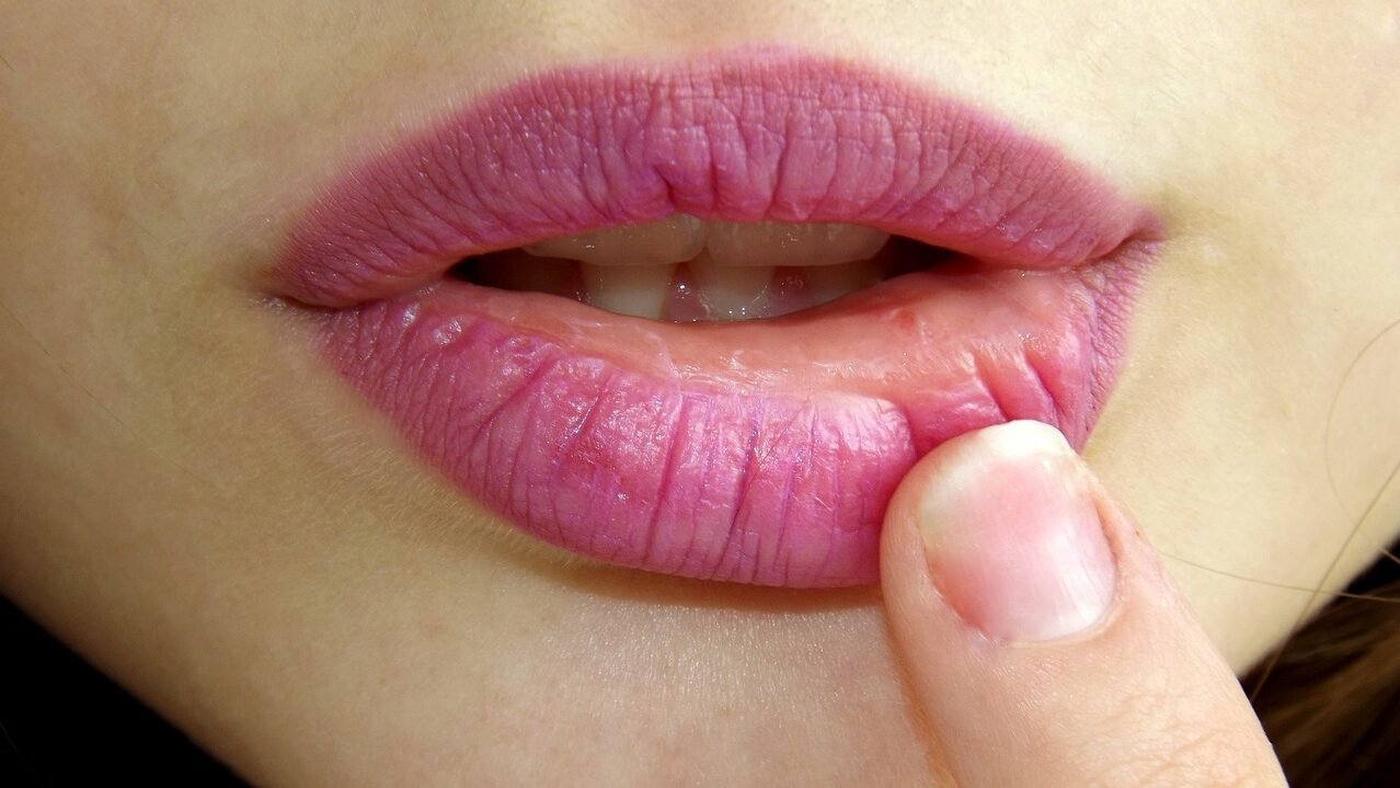 Avoid cracked lips in winter